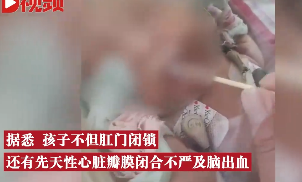 早產(chǎn)男嬰肛門閉鎖家長(zhǎng)崩潰 手術(shù)將面臨巨大經(jīng)濟(jì)壓力
