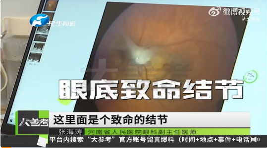 8歲女孩玩貓狗感染眼弓蛔蟲(chóng)致失明 醫(yī)生：早期癥狀不明顯很難發(fā)現(xiàn)