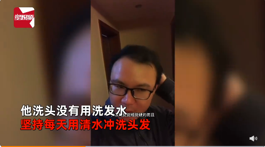 男子禿頂半個月不用洗發(fā)水后長出頭發(fā) 他個人認為洗發(fā)水對頭發(fā)傷害很大