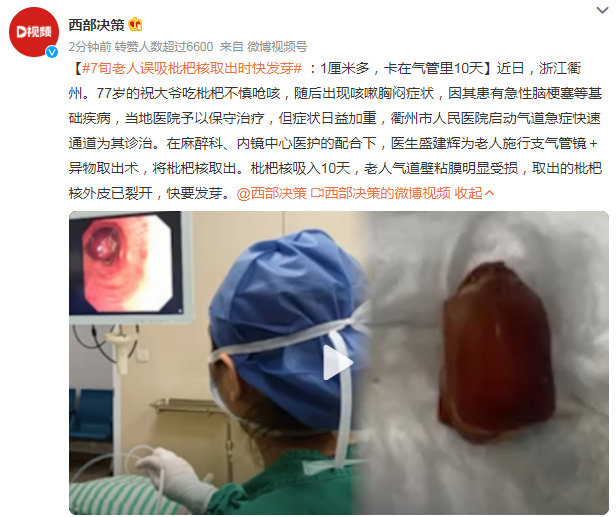 7旬老人誤吸枇杷核取出時快發(fā)芽 海姆立克急救法關(guān)鍵時刻能救命