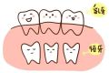 醫(yī)生將8歲女孩恒牙當(dāng)乳牙錯拔 乳牙和恒牙要如何區(qū)分?