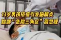 13歲男孩擠痘引發(fā)腦膜炎 三角區(qū)的痘痘千萬(wàn)不要盲目擠