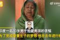 30歲男子植發(fā)后多器官衰竭死亡 網(wǎng)友“禿也沒什么可怕的”